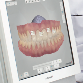 clyde-dental-ottawa-digital-impressions2